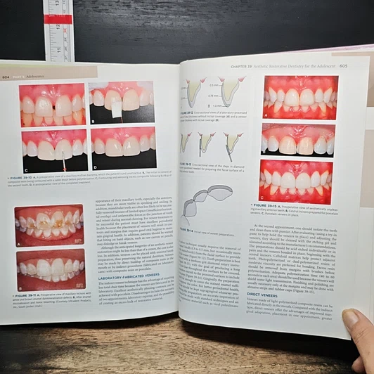 หนังสือ Pediatric Dentistry: Infancy Through Adolescence รูปที่ 10