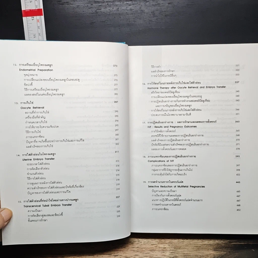 หนังสือ การปฏิสนธินอกร่างกาย ทางคลินิก รูปที่ 9