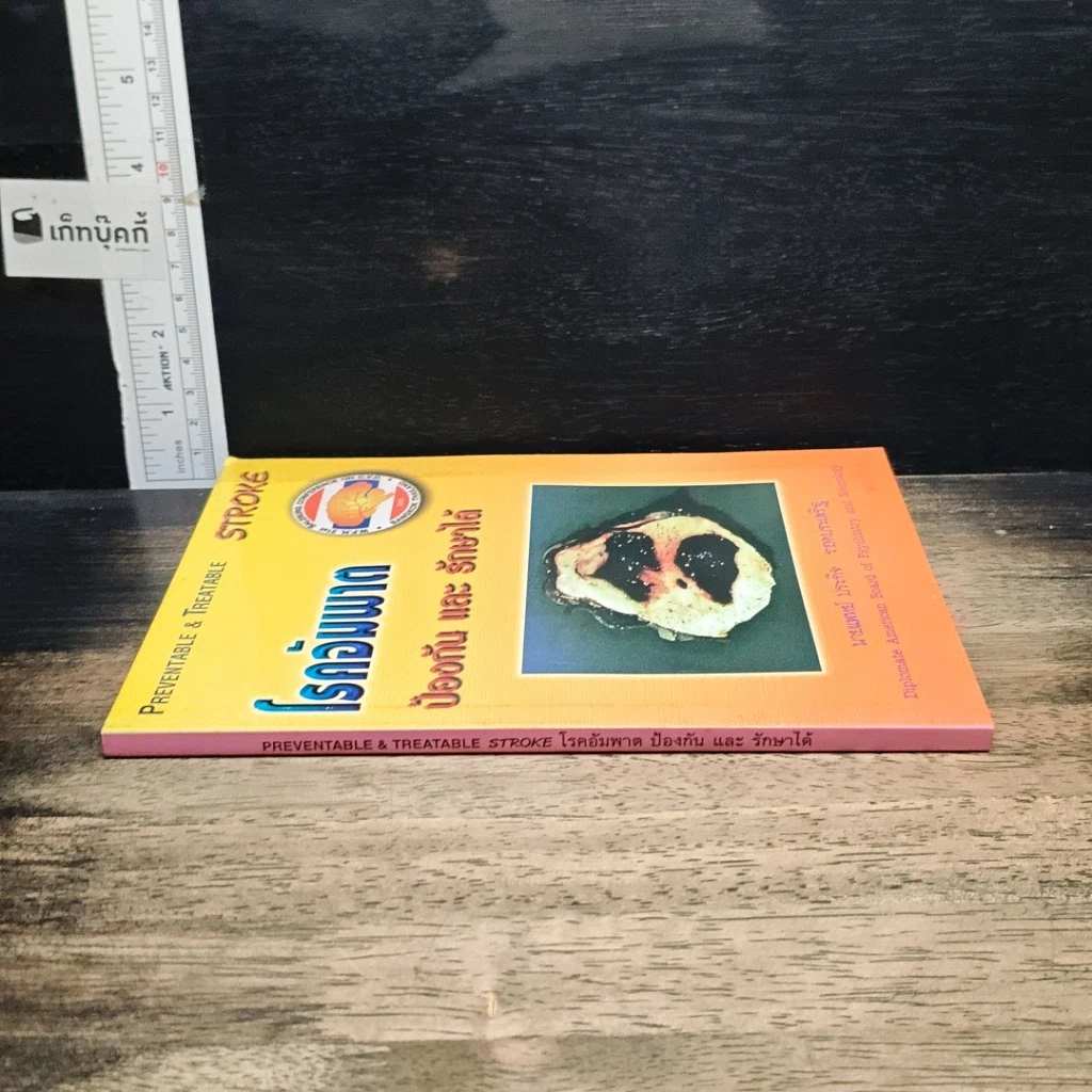 หนังสือ โรคอัมพาต ป้องกัน และรักษาได้ รูปที่ 3
