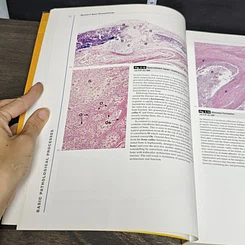 หนังสือ Wheater's Basic Histopathology รูปที่ 8