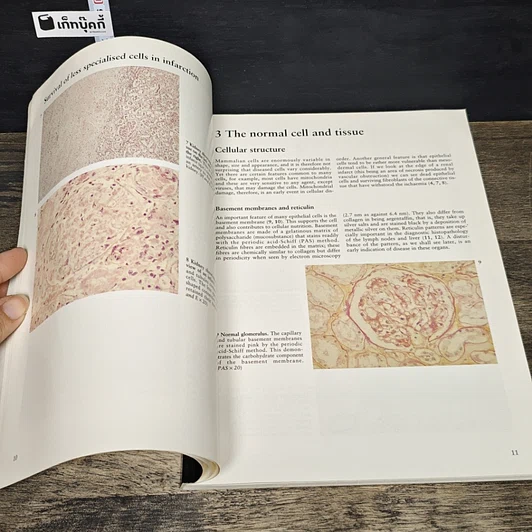 หนังสือ A Colour Atlas of General Pathology รูปที่ 8