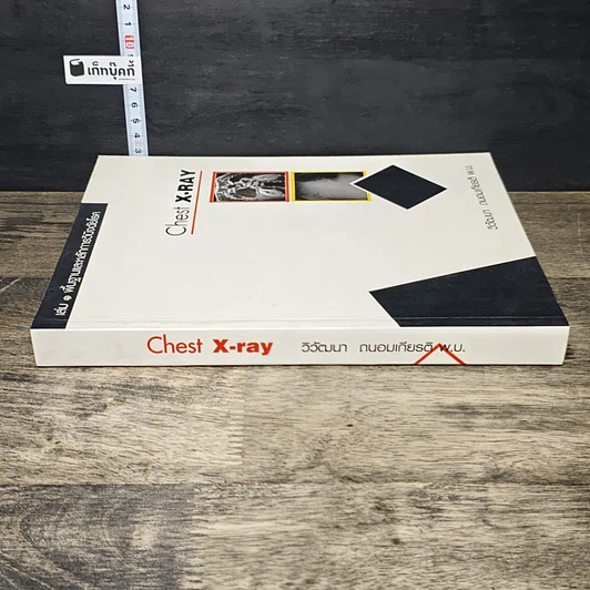 หนังสือ Chest X-RAY รูปที่ 2