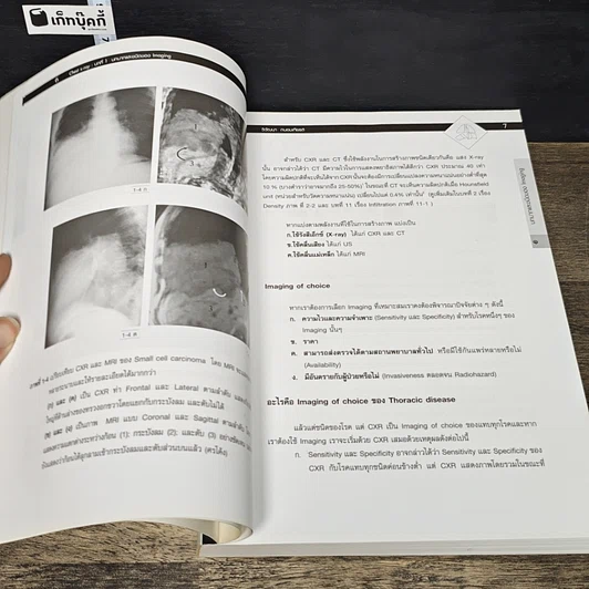 หนังสือ Chest X-RAY รูปที่ 7