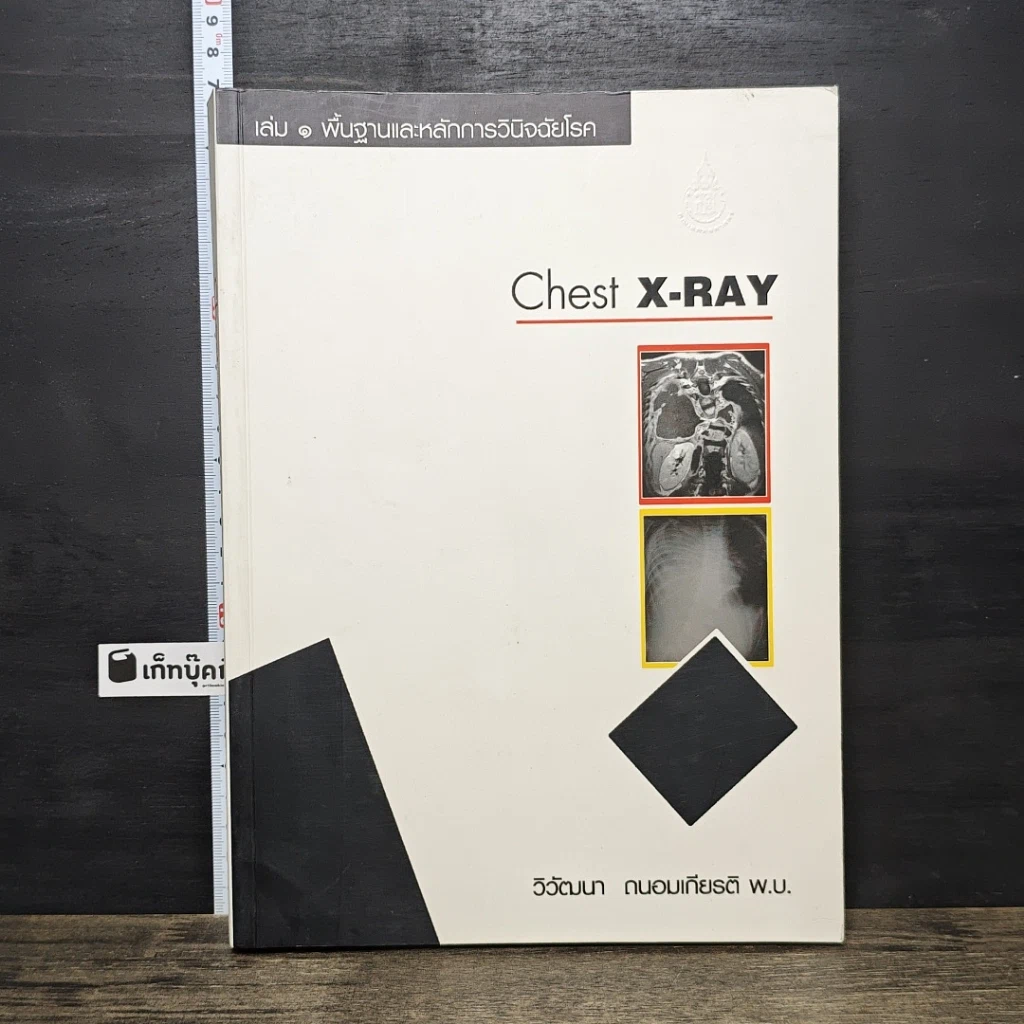 หนังสือ Chest X-RAY รูปที่ 1