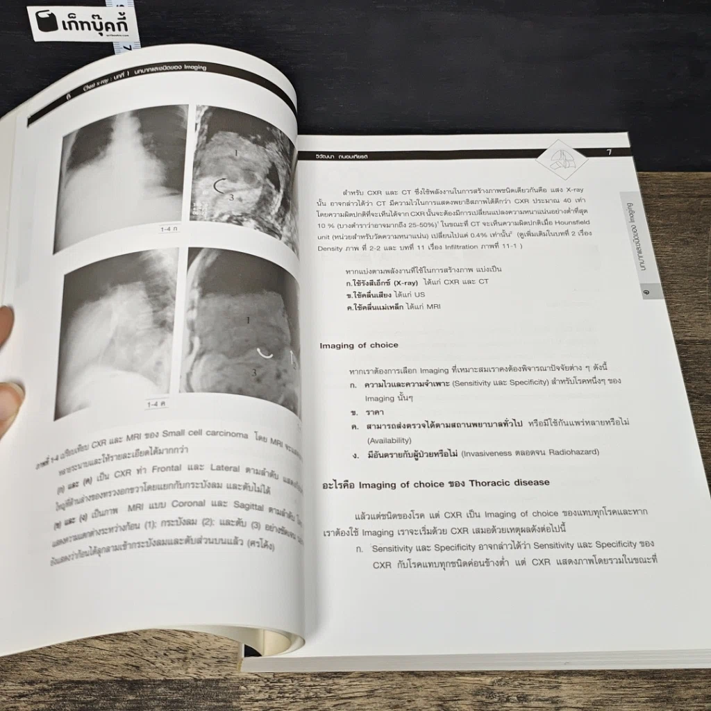 หนังสือ Chest X-RAY รูปที่ 7