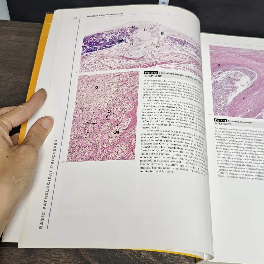 หนังสือ Wheater's Basic Histopathology รูปที่ 8
