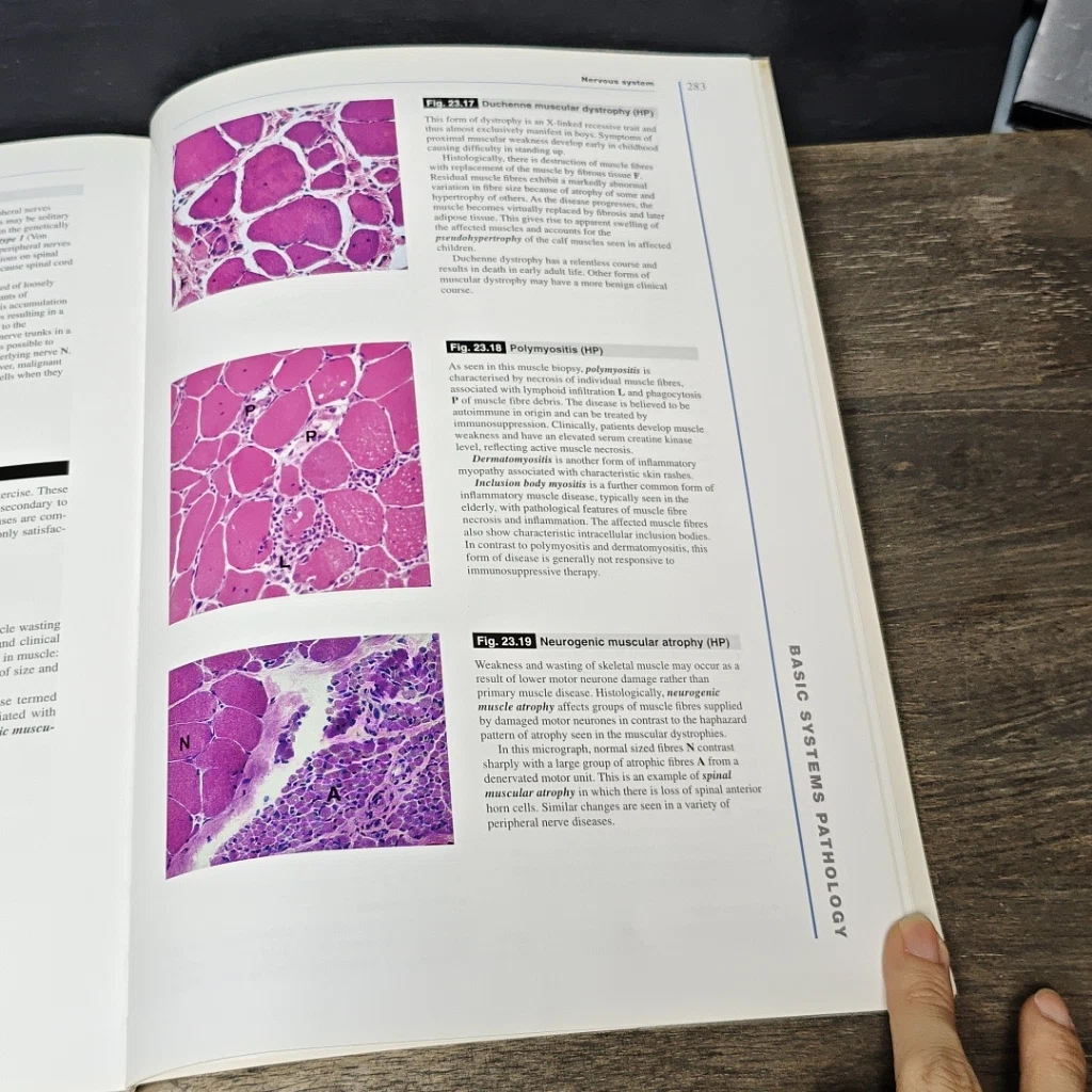หนังสือ Wheater's Basic Histopathology รูปที่ 11
