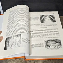 หนังสือ Essentials of Complete Denture Prosthodontics รูปที่ 7