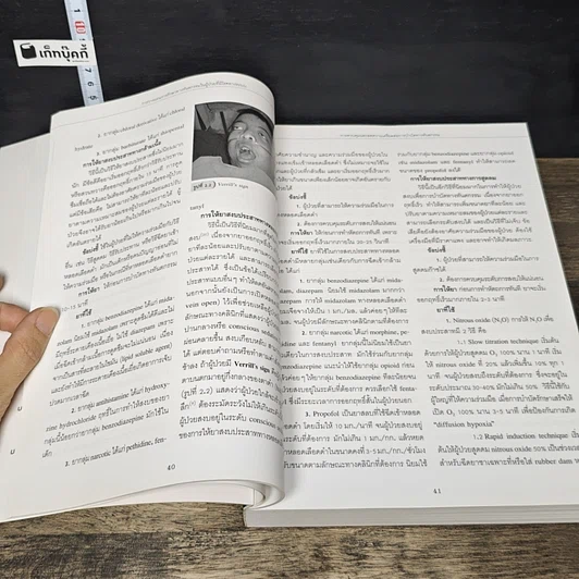 หนังสือ การวางแผนการรักษาทางทันตกรรม ในผู้ป่วยที่มีโรคทางระบบ รูปที่ 9