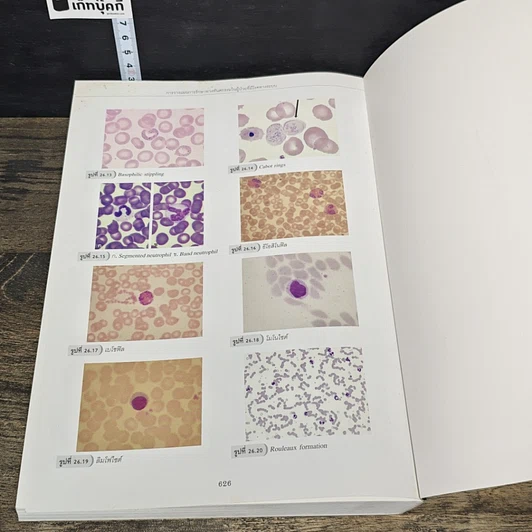 หนังสือ การวางแผนการรักษาทางทันตกรรม ในผู้ป่วยที่มีโรคทางระบบ รูปที่ 10