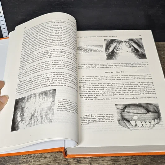 หนังสือ Essentials of Complete Denture Prosthodontics รูปที่ 7