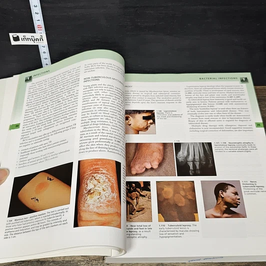 หนังสือ Color Atlas and Text of Clinical Medicine รูปที่ 8