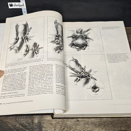 หนังสือ Mastery of Surgery Volume 2.1-2.2 รูปที่ 7