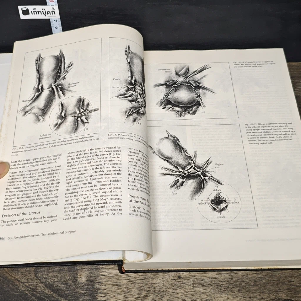 หนังสือ Mastery of Surgery Volume 2.1-2.2 รูปที่ 7