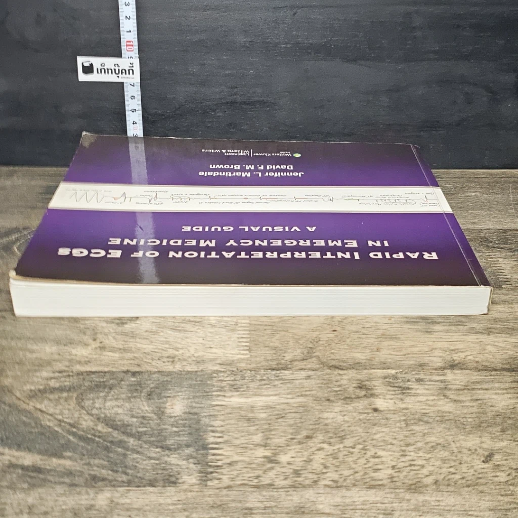 หนังสือ Rapid Interpretation of ECGs in Emergency Medicine รูปที่ 4