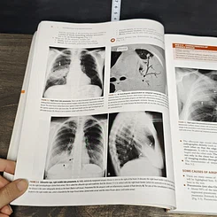 หนังสือ Learning Radiology: Recognizing the Basics รูปที่ 10