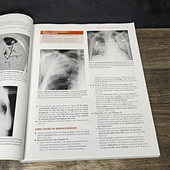 หนังสือ Learning Radiology: Recognizing the Basics รูปที่ 11