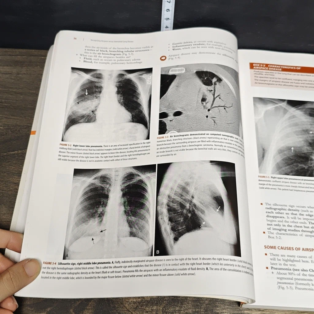 หนังสือ Learning Radiology: Recognizing the Basics รูปที่ 10