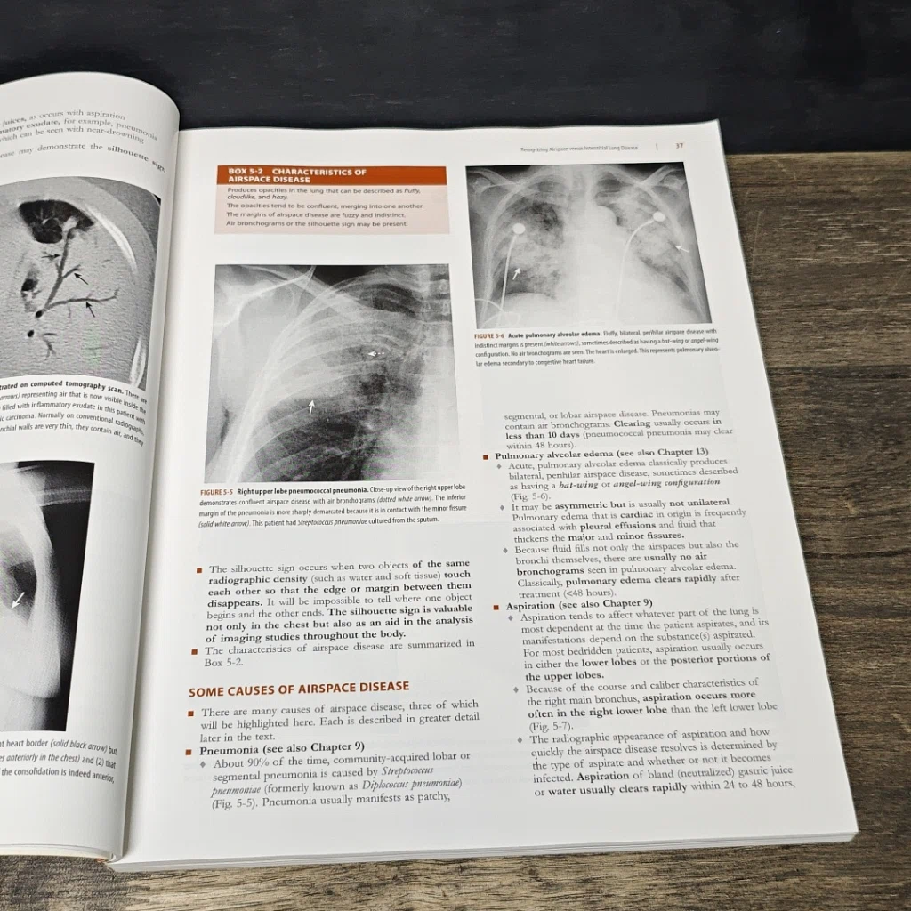 หนังสือ Learning Radiology: Recognizing the Basics รูปที่ 11